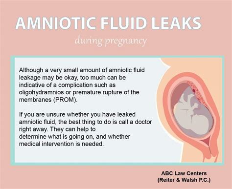 can amniotic fluid leak and then stop|Leaking Amniotic Fluid: Signs in 1st to 3rd Trimester